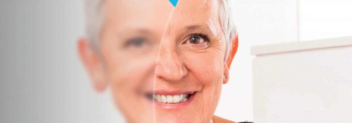 Cataract Vista Vision